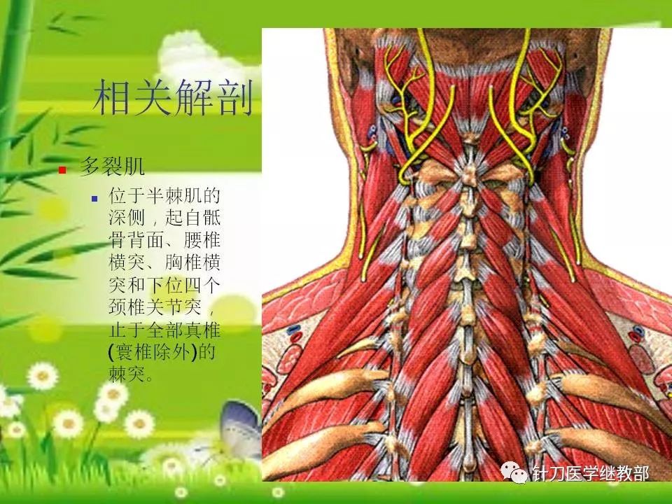 颈肌损伤型颈椎病