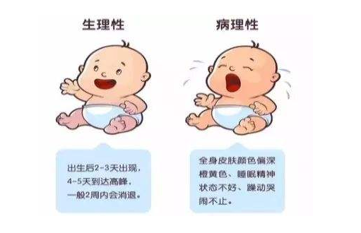                     婴儿游泳对宝宝生理性黄疸有作用吗？家长必看！