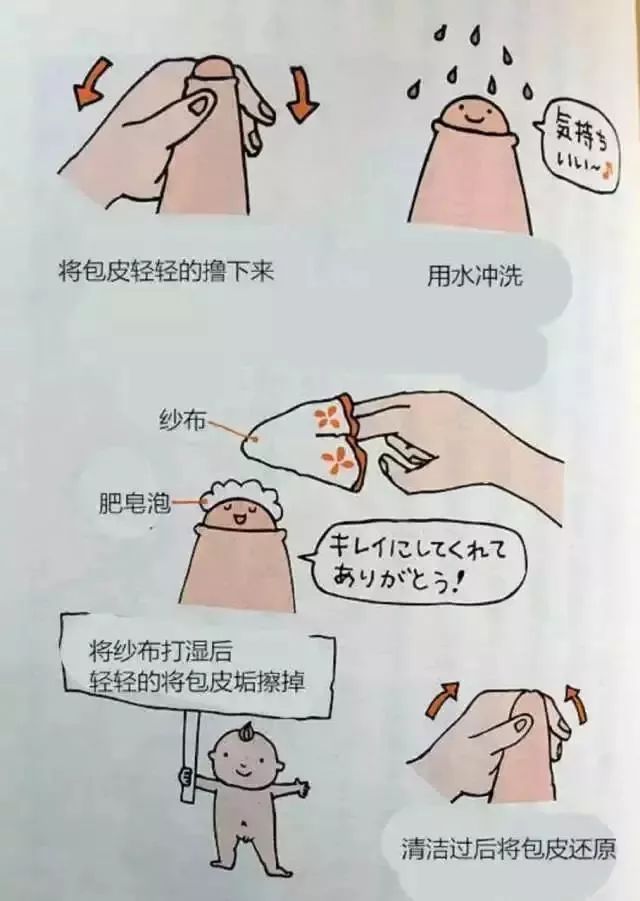 阴茎畸形 比如尿道下裂,隐匿阴茎,阴茎下曲,巨大尿道口等,就不要贸然