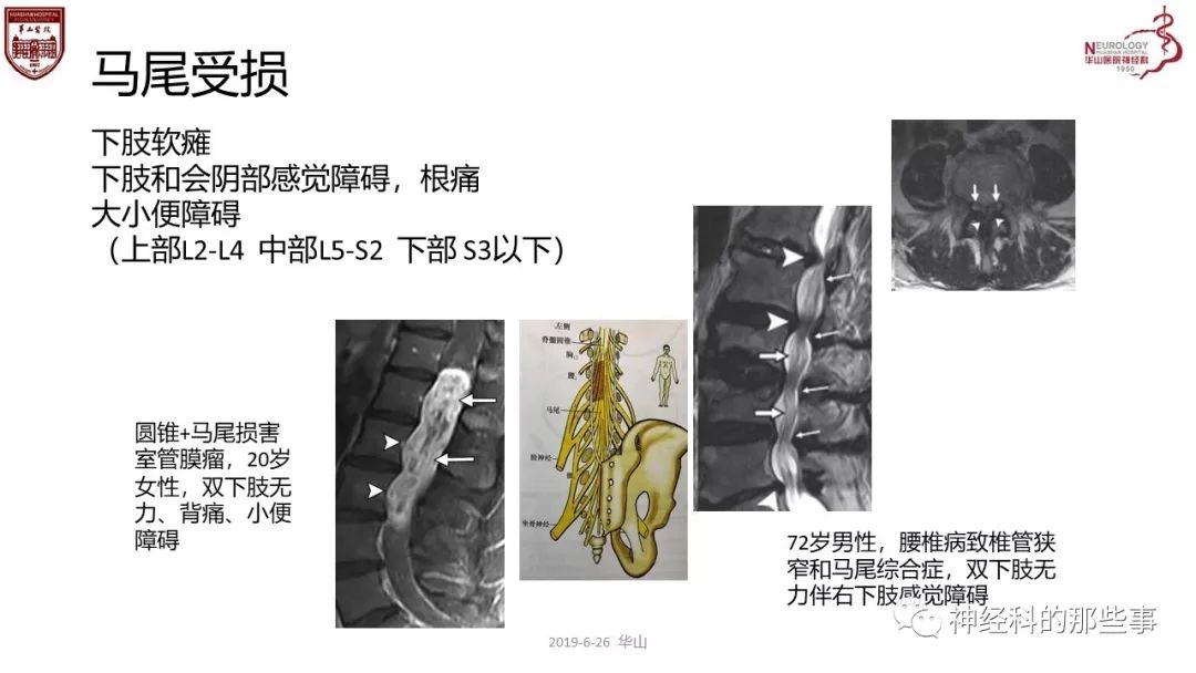 脊髓的解剖和定位诊断