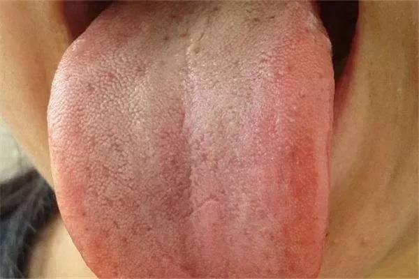                     宝宝夏季感冒，有7个症状，掌握3招有效调理方法，不用怕！