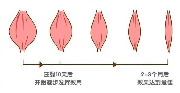 蛋白矫正沙发原理是什么_蛋白线是什么样子图片