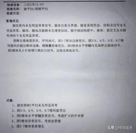 初步诊断:1.mnd-连枷腿综合征;2.肯尼迪病.