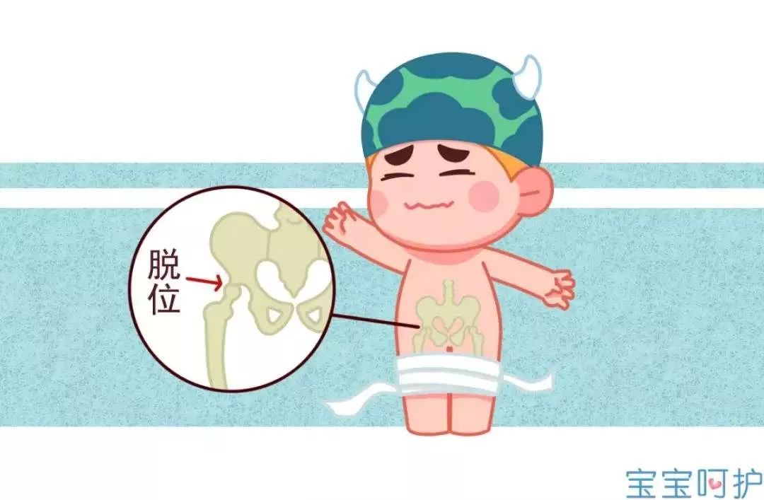                     注意宝宝双腿的这些表现，可能是得了这种骨骼病