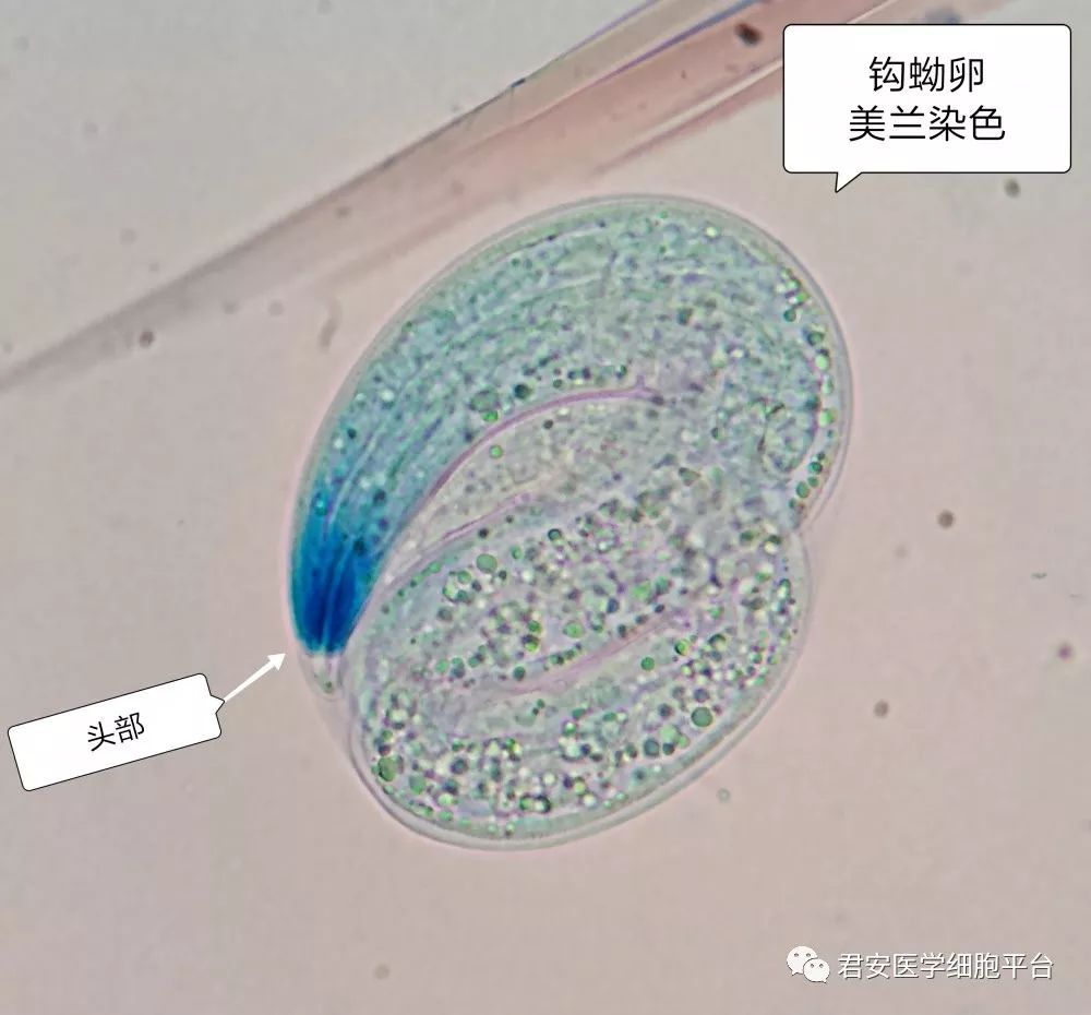 【独家报道】现场直播:钩虫宝宝破壳而出