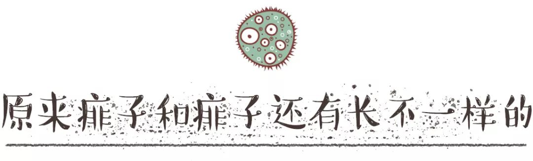                     原创            酷暑难耐的夏天，孩子皮肤频出状况，三招教你搞定恼人痱子！