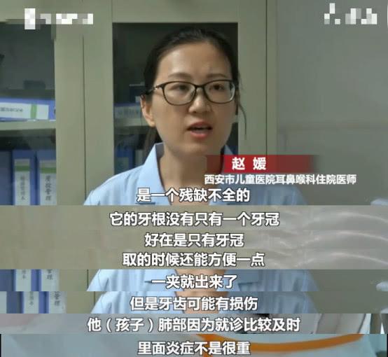                     7岁男童乳牙脱落告知家长，父母竟然不在意，险些卡住气管