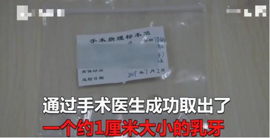                     7岁男童乳牙脱落告知家长，父母竟然不在意，险些卡住气管