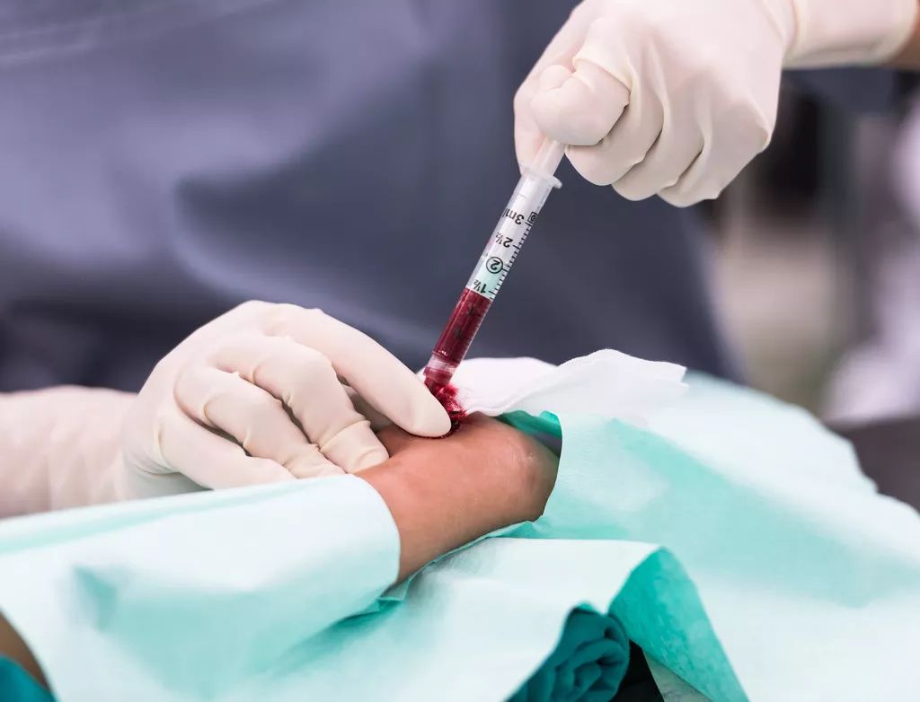 为什么检查时总要抽血，指尖抽血和胳膊抽血，结果会不一样吗？|病理性|抽血|检查|静脉|-健康界