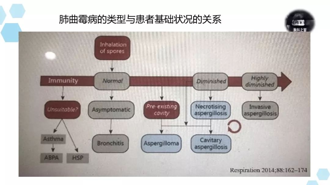 该患考虑气道侵袭性曲霉病,伴有对曲霉的变态反应,但还达不到abpa的