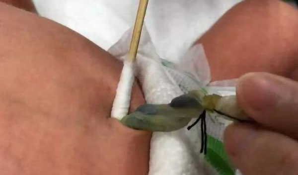                     原创            宝宝出生后妈妈千万不要掉以轻心，特别是剪脐带的伤口