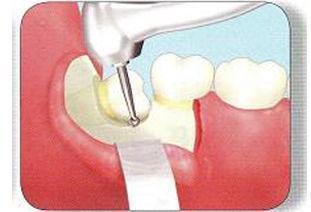 怎么才能让牙齿越来越健康 d4b211b305614055be4581a8b2421f34.jpeg