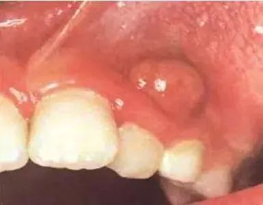 4d968be6c20b4b8183974afffeee40f6.jpeg