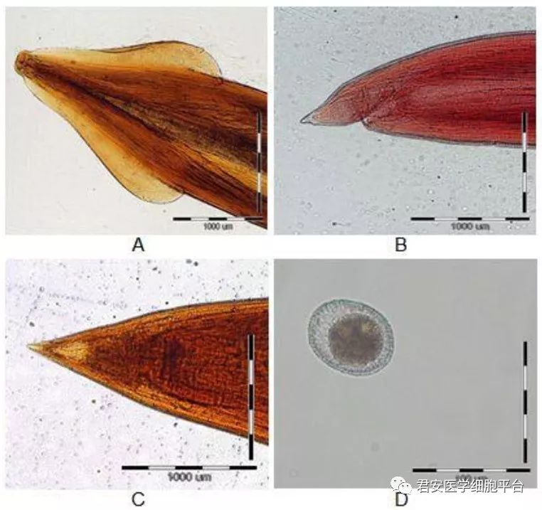 看图识细胞(第49期)——寄生虫篇_蛔虫
