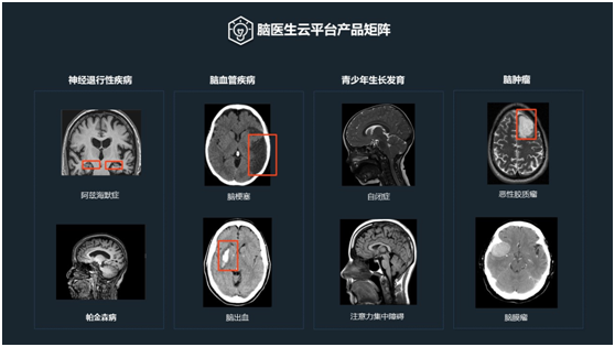 快讯| 脑医生Dr.Brain完成数千万元A轮融资,全方位展开商业网点布局 必发888