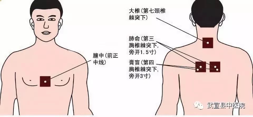 ①呼吸系统:支气管哮喘,过敏性鼻炎,慢性鼻咽炎,慢性支气管炎,肺炎