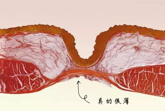 为什么抠肚脐眼会有一种奇怪的感觉?