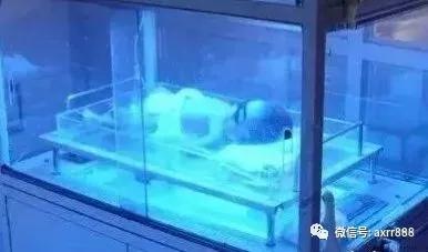                     益生菌是解决宝宝黄疸又安全又有效的方法！