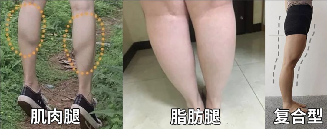 xo型腿,小腿外翻,肌肉腿……难道我天生就和大长腿无缘吗?| 好课推荐