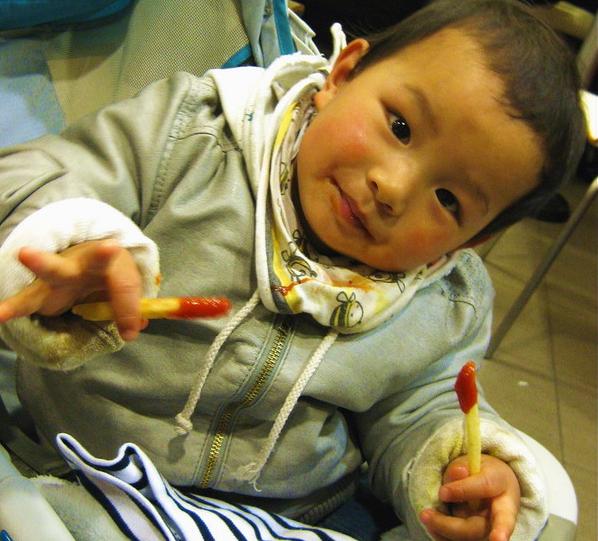                     2岁男孩双肾长满结石！医生坦言：这2种辅食添加过早