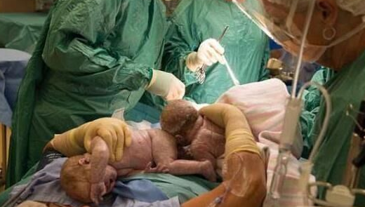 孕妇分娩自己动手,接生了腹中的双胞胎,曾生过9个孩子