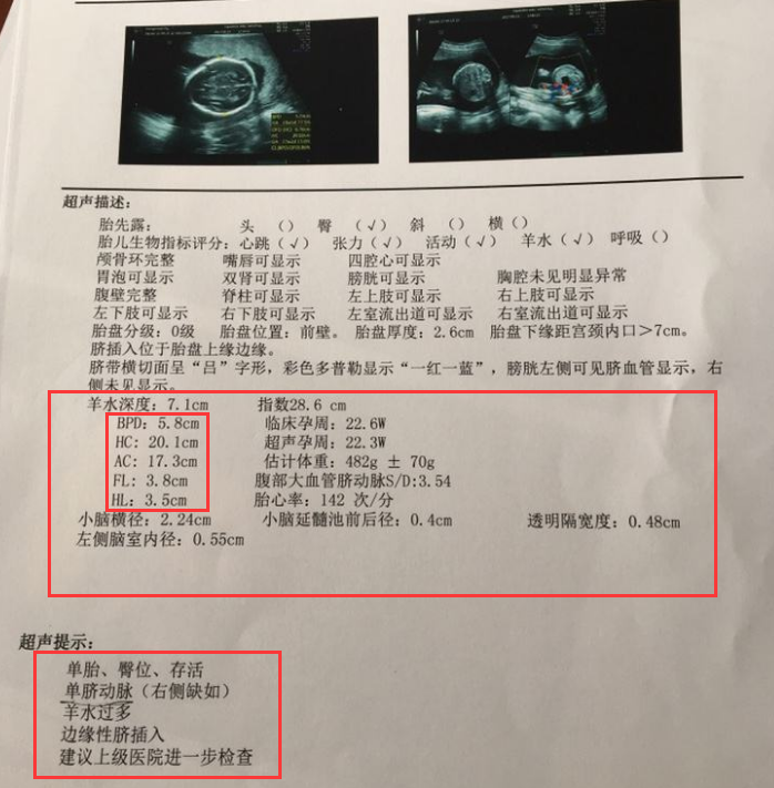 孕妈咪做四维彩超能懂报告单上几组数据胎儿就没小秘密了