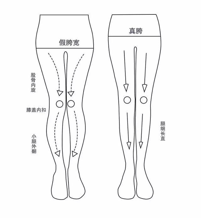 大腿根粗怎么办