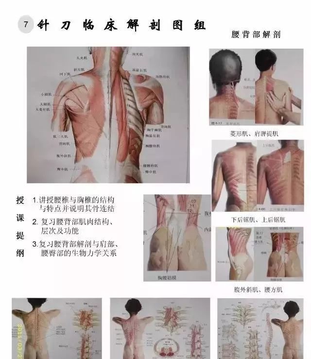 针刀临床解剖图