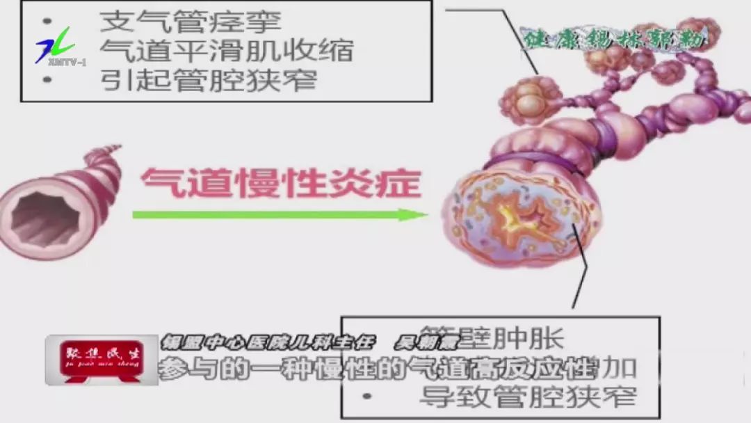 d8f5f957ae164a4fb4d92aea7904601c.jpeg