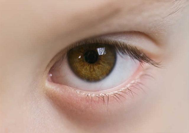 眼睛出现这4种异常,并不简单,可能是疾病来袭
