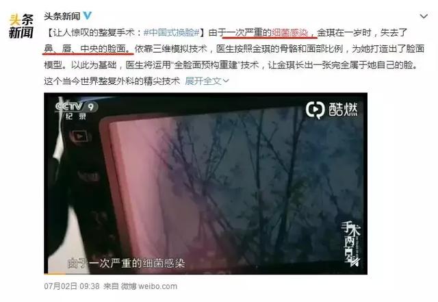                     原创            一次细菌感染竟让女童＂毁容＂？细菌感染or病毒感染早分清