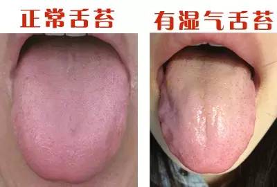 洗漱时:看舌苔3●如果亲觉得看便便太呕心,那就看手纸吧:正常便便只要