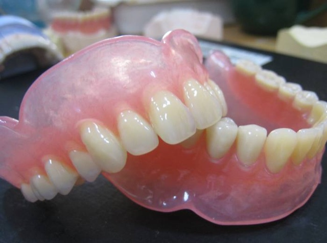 包括可摘局部义齿和全口义齿,是利用剩余天然牙,基托下的黏膜和骨组织