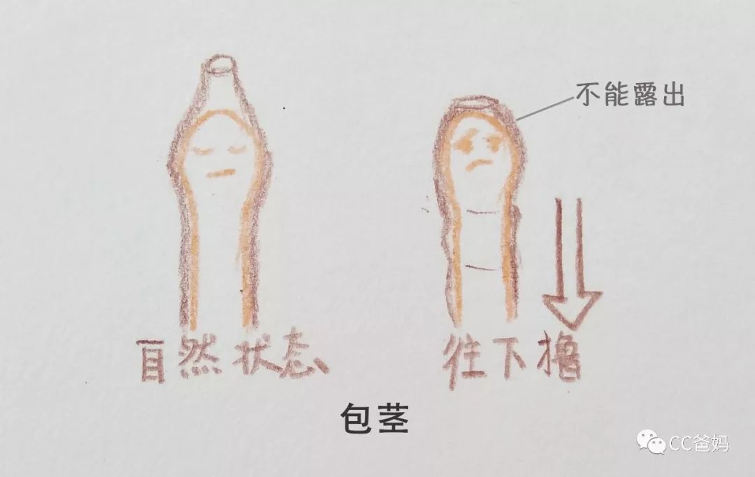                     男宝宝包皮要不要割？这几种情况千万别大意！