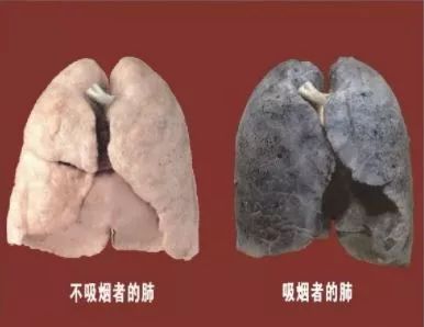 一支烟引发的讨论：想要孩子吗?戒烟吧！（一）_生殖