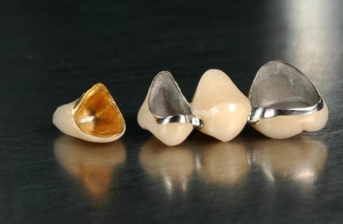 镶烤瓷牙不舒服怎么办?学会这2种方法,吃啥都