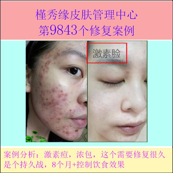 皮肤修复需要注意什么 0d6cecaf3c434ed88f836c9d176d2cb2.jpeg