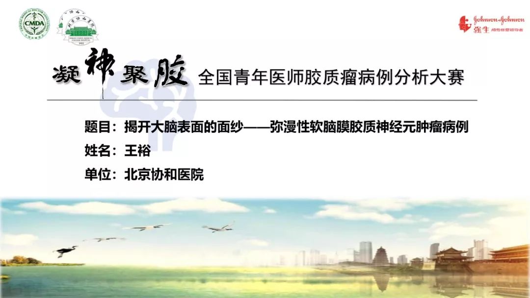 凝神聚胶王裕医师揭开大脑表面的面纱弥漫性软脑膜胶质神经元肿瘤病例