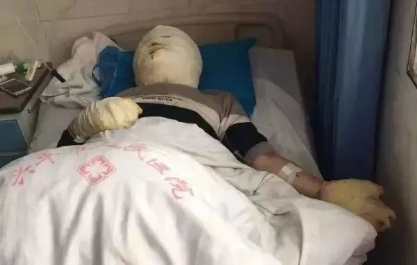                     它又爆炸了！女孩左眼被炸伤...千万小心孩子手上这玩具！