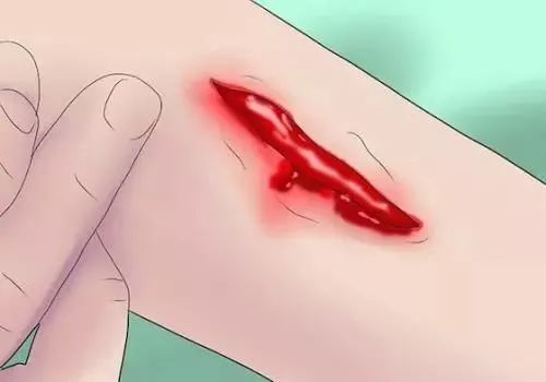                     虎爸一个动作导致女儿进ICU：这些坑娃的土方你肯定在用？