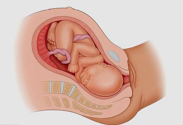 原创为了避免脐带绕颈,进入孕中期后,孕妇要做好这3件事!