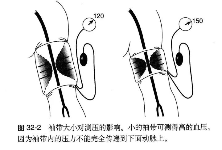 监护仪hr过低怎么办