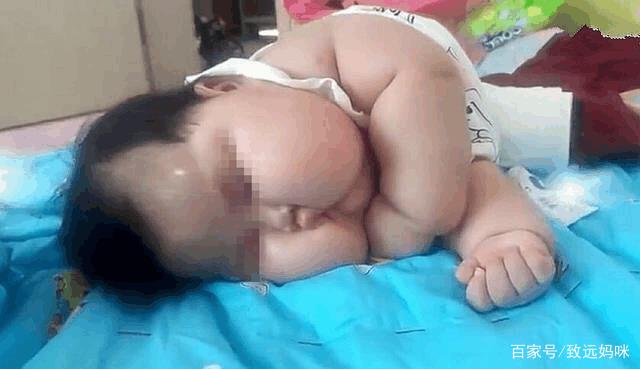                     奶奶把几个月大孙子喂成个“球”，自夸营养好，医生却说无知！
