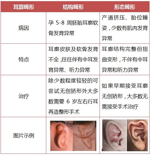 宝宝耳朵长得不好看(耳廓畸形) 需要治疗吗? 怎么治疗? 何时治疗?