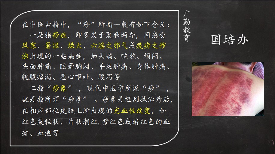 刮痧有什么科学原理_心口窝刮痧有什么作用