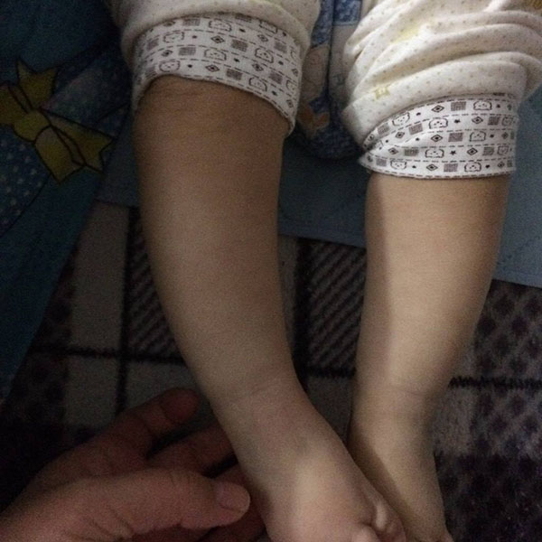                     原创            不想让宝宝“罗圈腿”，家长必须要注意的几件事