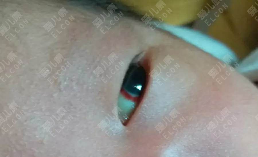                     宝宝嘴巴一直动就是饿了？该喂奶吗？还真不一定…