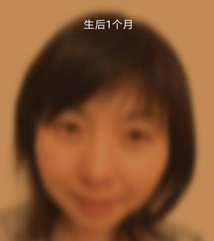 婴儿几个月可以看见瞳孔 67b0f30483624b2a99476f0f3587fba9.jpeg