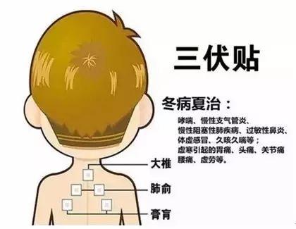 息县妇幼保健院儿童康复室"三伏贴"即将开贴啦