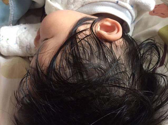                     孩子爱出汗是因为缺钙？医生：八杆子打不着，主要是这3个原因